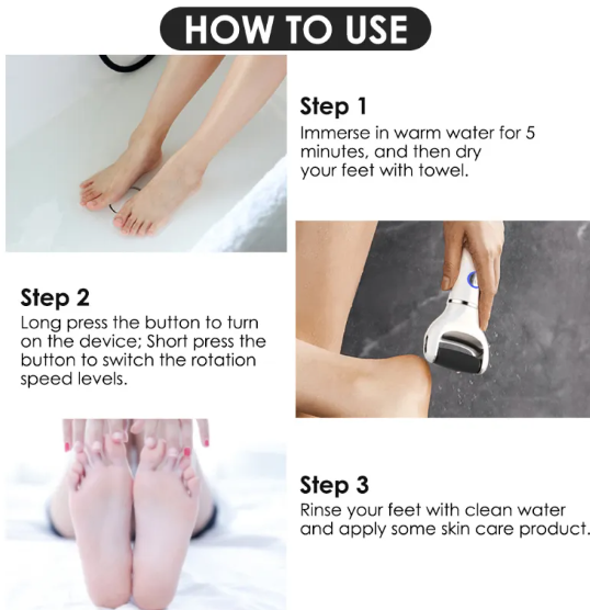 Dead Skin Remover