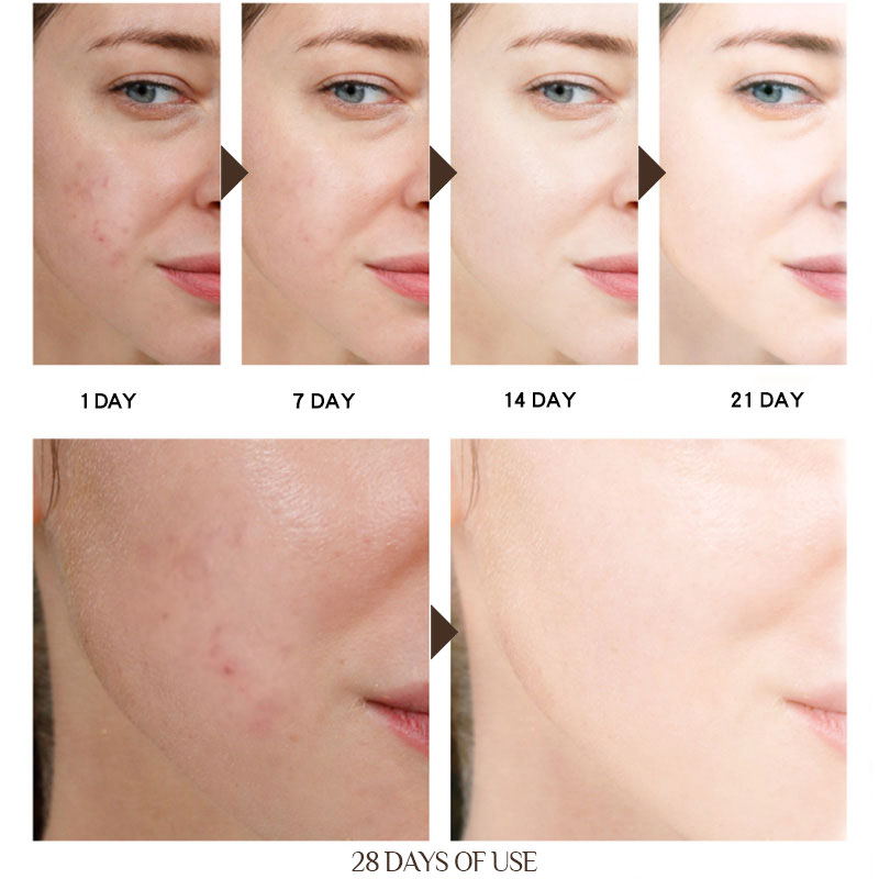 Rejuvenating Anti-Aging Moisturizing Skin Cream